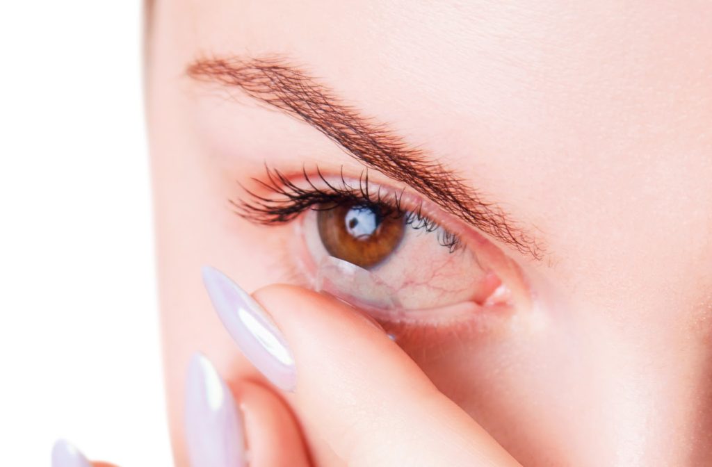 Woman with bloodshot dry eye inserting contact lens