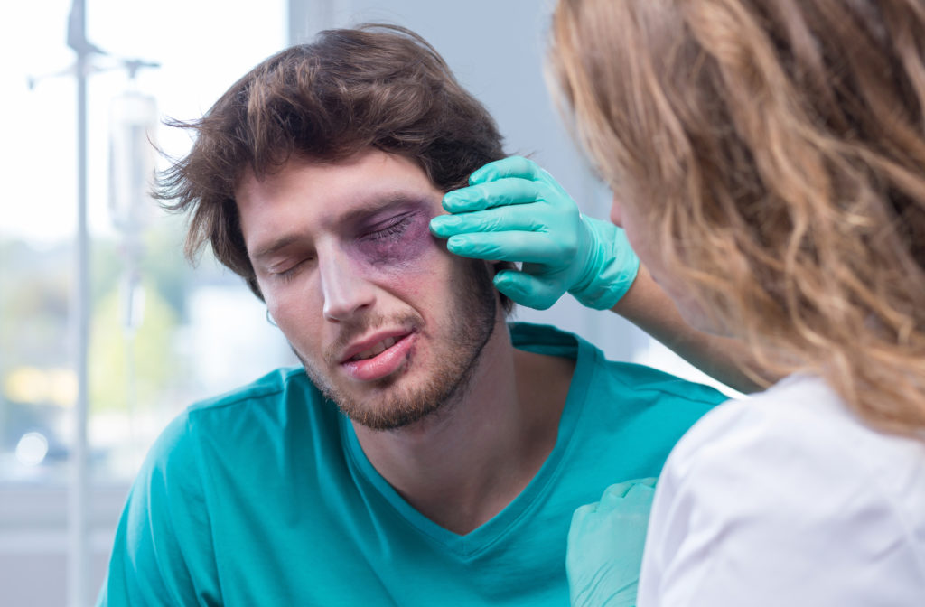 Optometrist looking at man with black eye that has come in for emergency eye service required to look at his vision