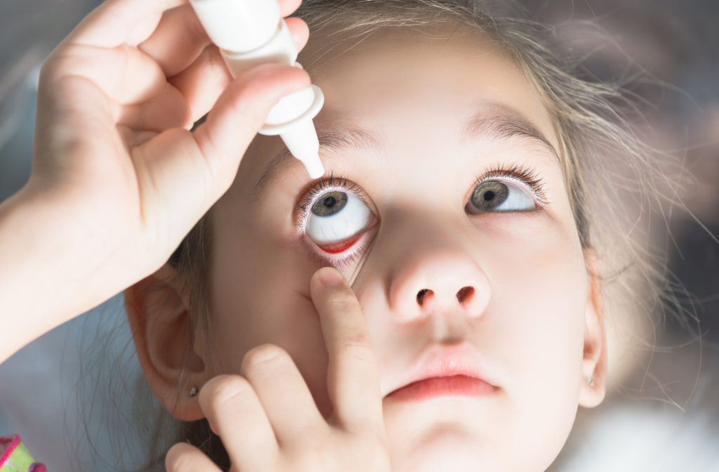 Young girl putting in atropine eye drops to help control myopia